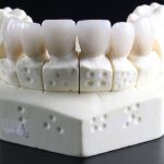 محققان می گویند استرس مثبت در ترمیم بافت دندان موثر است